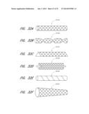 EXPANDABLE TIP ASSEMBLY FOR THROMBUS MANAGEMENT diagram and image