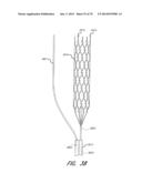 EXPANDABLE TIP ASSEMBLY FOR THROMBUS MANAGEMENT diagram and image