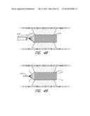 EXPANDABLE TIP ASSEMBLY FOR THROMBUS MANAGEMENT diagram and image