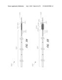 EXPANDABLE TIP ASSEMBLY FOR THROMBUS MANAGEMENT diagram and image