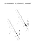 EXPANDABLE TIP ASSEMBLY FOR THROMBUS MANAGEMENT diagram and image