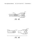 EXPANDABLE TIP ASSEMBLY FOR THROMBUS MANAGEMENT diagram and image