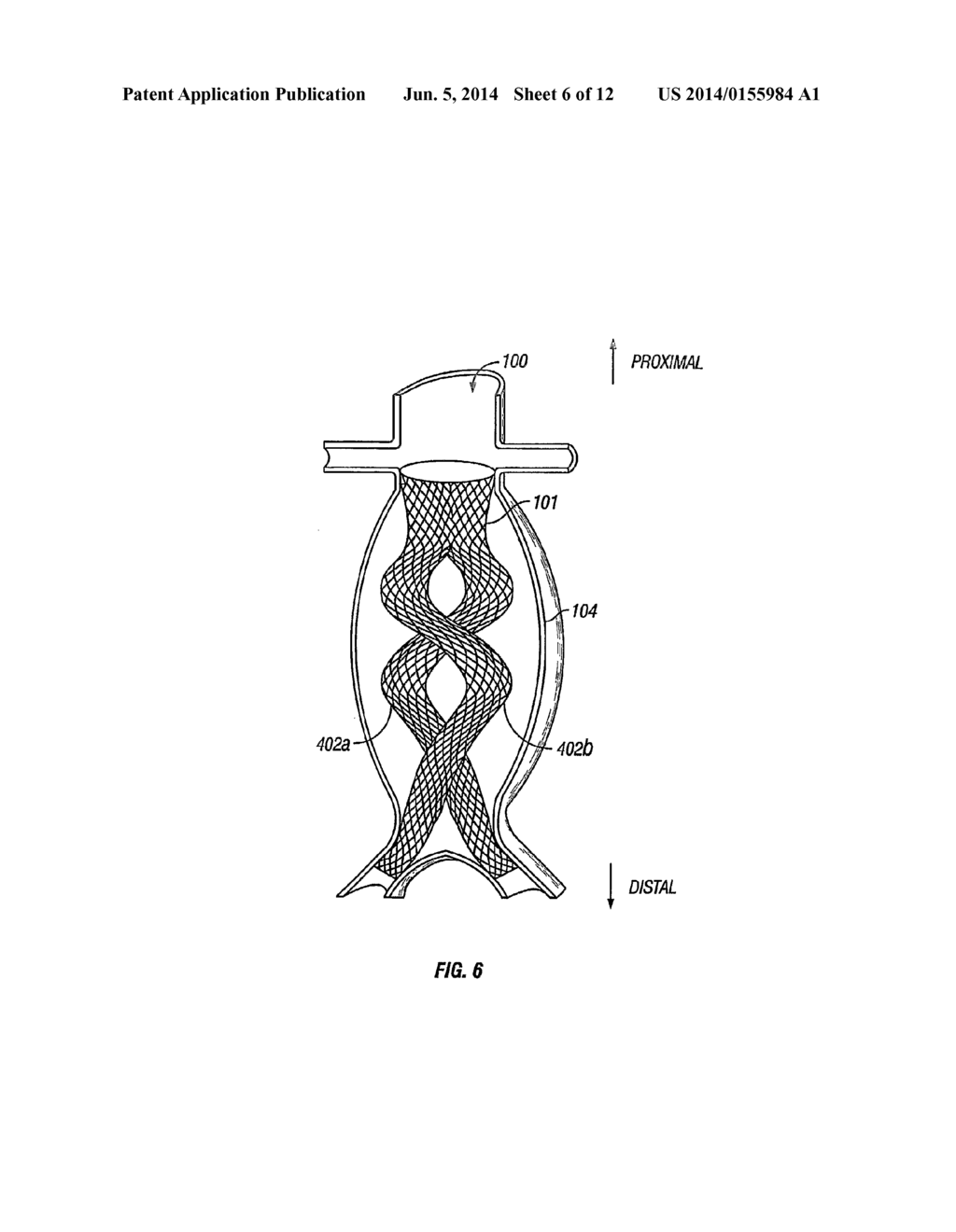 DEVICES AND METHODS FOR TREATMENT OF ABDOMINAL AORTIC ANEURYSM - diagram, schematic, and image 07