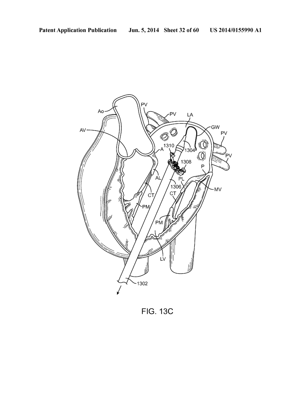 METHODS AND APPARATUS FOR LOADING A PROSTHESIS ONTO A DELIVERY SYSTEM - diagram, schematic, and image 33