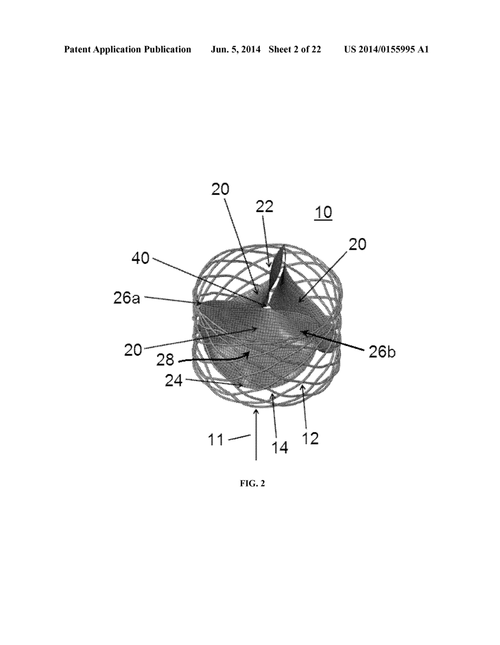 PROSTHETIC HEART VALVE - diagram, schematic, and image 03