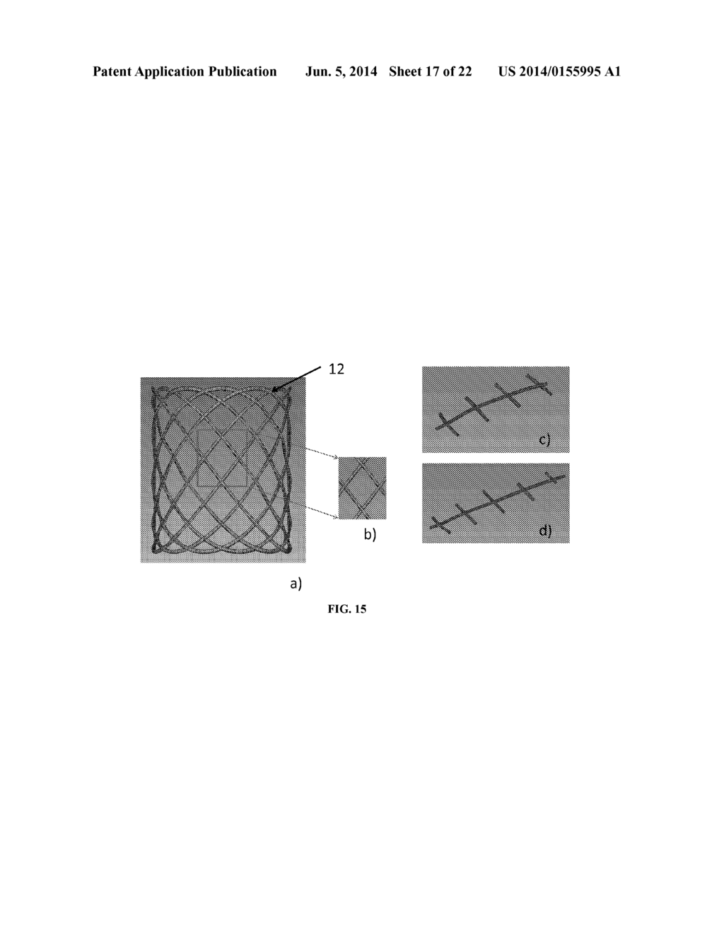 PROSTHETIC HEART VALVE - diagram, schematic, and image 18