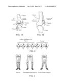 Method and Apparatus for Altering Biomechanics of the Articular Joints diagram and image