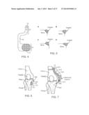 Method and Apparatus for Altering Biomechanics of the Articular Joints diagram and image