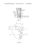 Method and Apparatus for Altering Biomechanics of the Articular Joints diagram and image