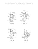 Method and Apparatus for Altering Biomechanics of the Articular Joints diagram and image