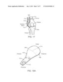 Method and Apparatus for Altering Biomechanics of the Articular Joints diagram and image