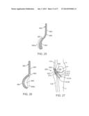 Method and Apparatus for Altering Biomechanics of the Articular Joints diagram and image