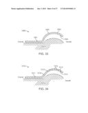 Method and Apparatus for Altering Biomechanics of the Articular Joints diagram and image