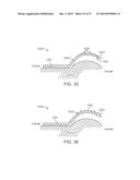 Method and Apparatus for Altering Biomechanics of the Articular Joints diagram and image