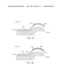 Method and Apparatus for Altering Biomechanics of the Articular Joints diagram and image