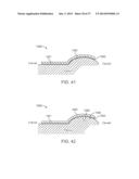 Method and Apparatus for Altering Biomechanics of the Articular Joints diagram and image