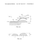 Method and Apparatus for Altering Biomechanics of the Articular Joints diagram and image