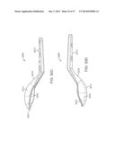 Method and Apparatus for Altering Biomechanics of the Articular Joints diagram and image