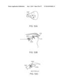 Method and Apparatus for Altering Biomechanics of the Articular Joints diagram and image