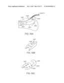 Method and Apparatus for Altering Biomechanics of the Articular Joints diagram and image