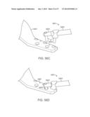 Method and Apparatus for Altering Biomechanics of the Articular Joints diagram and image