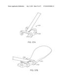 Method and Apparatus for Altering Biomechanics of the Articular Joints diagram and image