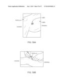 Method and Apparatus for Altering Biomechanics of the Articular Joints diagram and image