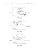 Method and Apparatus for Altering Biomechanics of the Articular Joints diagram and image