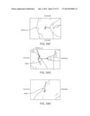 Method and Apparatus for Altering Biomechanics of the Articular Joints diagram and image