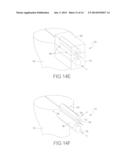 FLEX ANCHOR FOR ATTACHING A PROSTHESIS TO BONE diagram and image