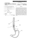 STENT SYSTEM AND METHODS OF USE diagram and image