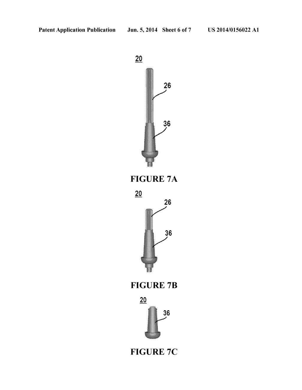 Percutaneous Osseointegrated Prosthetic Implant System - diagram, schematic, and image 07