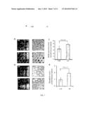 WDR13 AS A NOVEL BIOMARKER USEFUL FOR TREATING DIABETES AND CANCER diagram and image