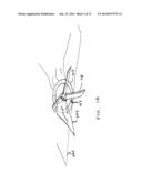 INTEGRATED BEDDING COVER SYSTEM AND METHOD diagram and image