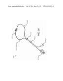 Cannula For Minimizing Dilution Of Dosing During Nitric Oxide Delivery diagram and image