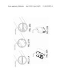 Cannula For Minimizing Dilution Of Dosing During Nitric Oxide Delivery diagram and image