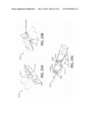 Cannula For Minimizing Dilution Of Dosing During Nitric Oxide Delivery diagram and image