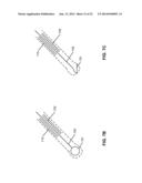 ELECTRONIC STYLUS WITH LOW SKEW TIP FOR CAPACITIVE TOUCH SCREENS diagram and image