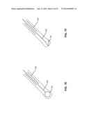 ELECTRONIC STYLUS WITH LOW SKEW TIP FOR CAPACITIVE TOUCH SCREENS diagram and image