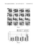 BIOMARKER-TARGETING CONTRAST AGENTS AND THEIR USE IN MAGNETIC RESONANCE     IMAGING FOR DETECTION OF ATHEROSCLEROTIC PLAQUE diagram and image