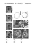 BIOMARKER-TARGETING CONTRAST AGENTS AND THEIR USE IN MAGNETIC RESONANCE     IMAGING FOR DETECTION OF ATHEROSCLEROTIC PLAQUE diagram and image
