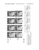 BIOMARKER-TARGETING CONTRAST AGENTS AND THEIR USE IN MAGNETIC RESONANCE     IMAGING FOR DETECTION OF ATHEROSCLEROTIC PLAQUE diagram and image