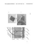 HEMOSTATIC FOAM diagram and image