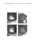 HEMOSTATIC FOAM diagram and image