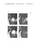 HEMOSTATIC FOAM diagram and image