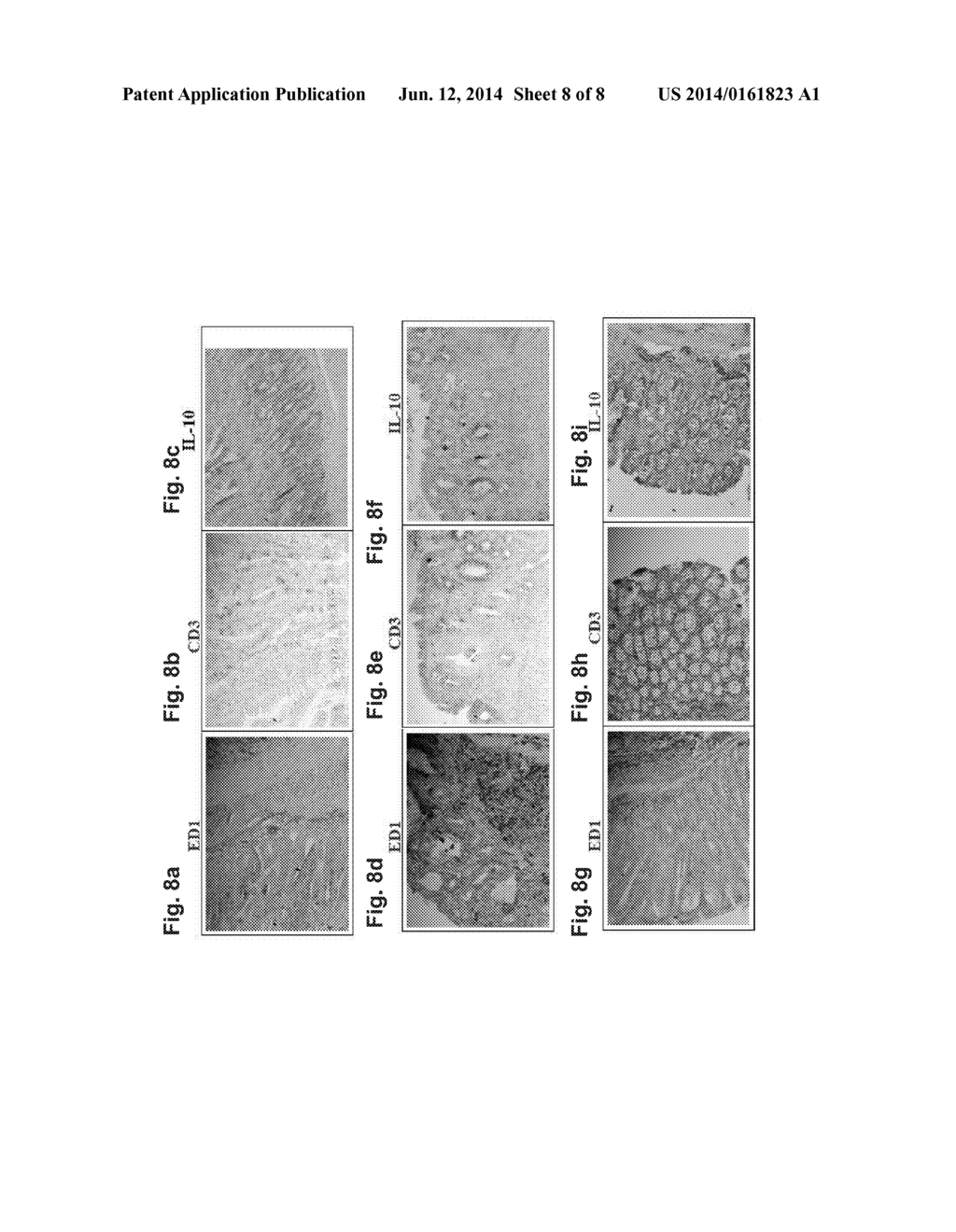 COMPOSITIONS AND METHODS FOR DIAGNOSING AND TREATING AN INFLAMMATION - diagram, schematic, and image 09