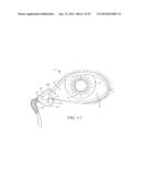 DRUG DELIVERY METHODS, STRUCTURES, AND COMPOSITIONS FOR NASOLACRIMAL     SYSTEM diagram and image