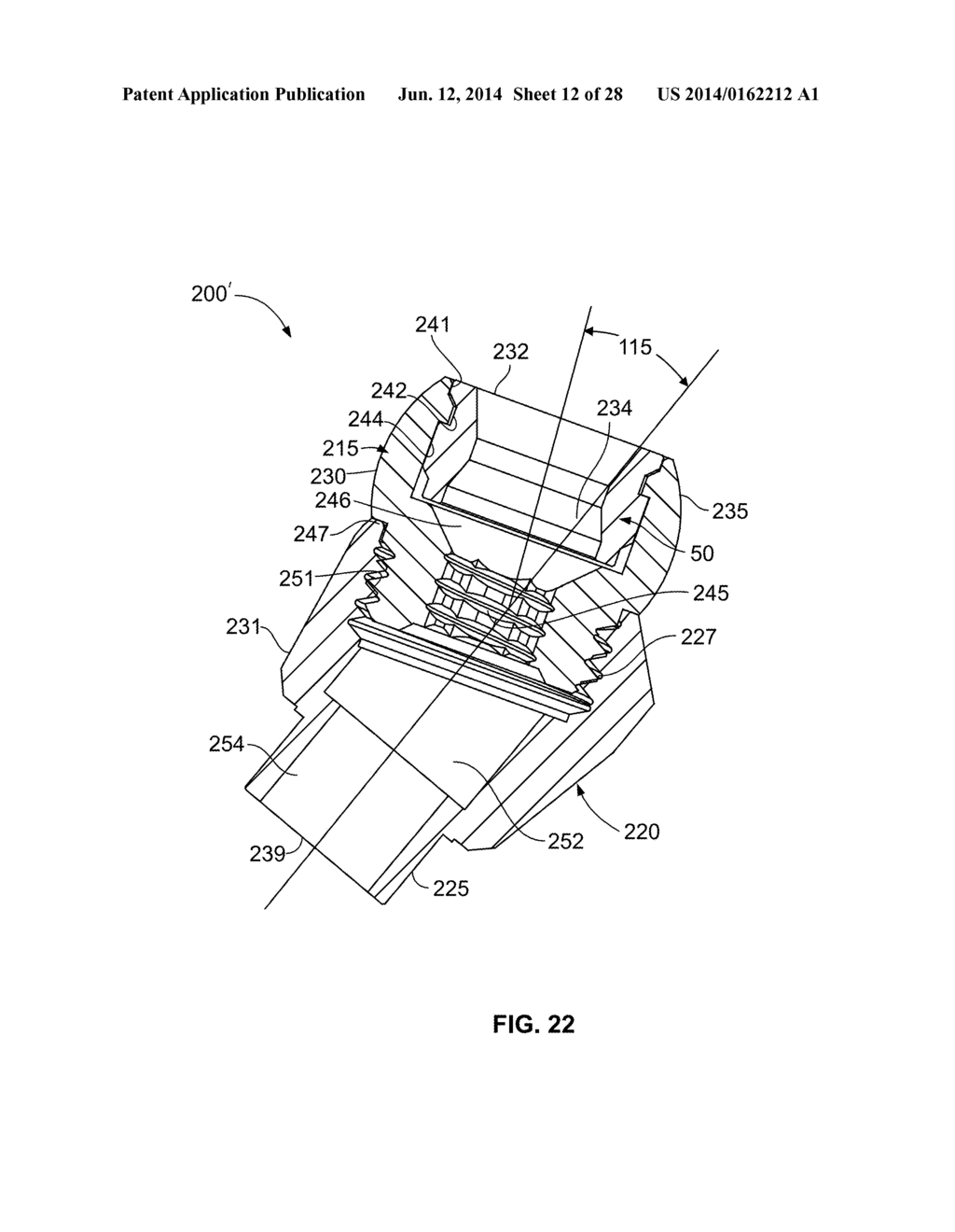 FIXED HYBRID DENTAL ATTACHMENT DEVICE AND METHODS OF USING SAME - diagram, schematic, and image 13