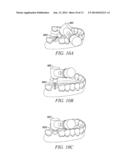 SURGICAL GUIDE FABRICATION diagram and image