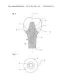 ABUTMENT FOR AN ARTIFICIAL DENTAL PROSTHESIS, ARTIFICIAL DENTAL PROSTHESIS     AND A METHOD FOR PRODUCING AND/OR IMPLANTING AN ARTIFICIAL DENTAL     PROSTHESIS diagram and image